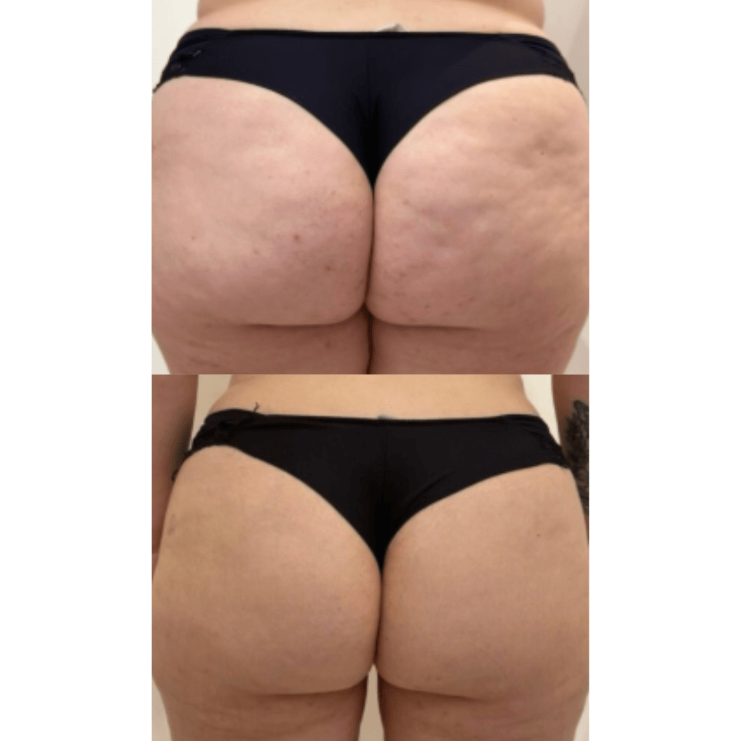 Brazilian Booty Cream - Crema para glúteos